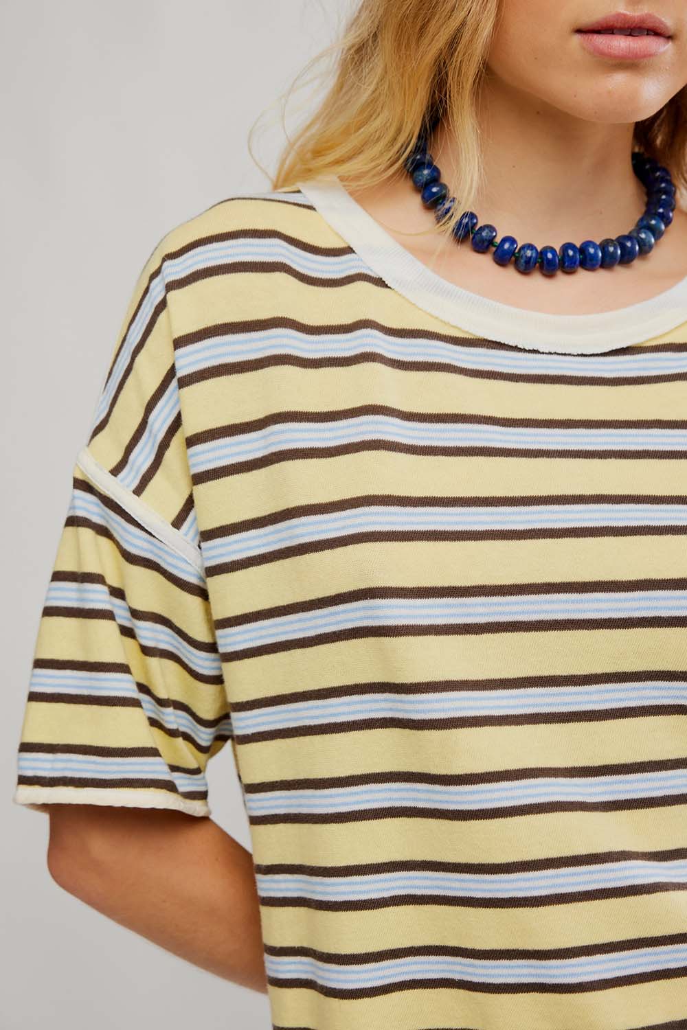 Free People - Clean Rugby Tee - Yellow Combo - Detail